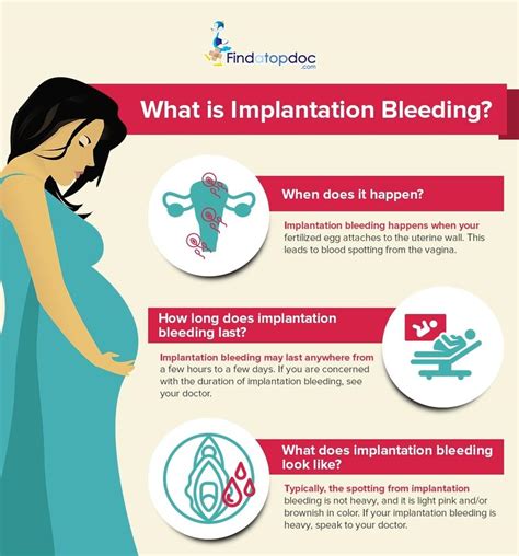 IMPLANTATION BLEEDING can be treated - FindaTopDoc