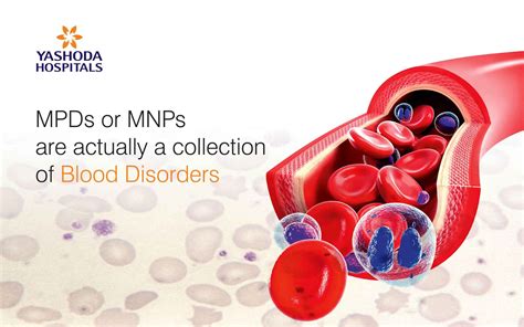 Myeloproliferative Disorders (MPD): Symptoms and Treatment | MPD Blood Disorder