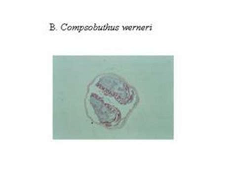 shows the structure of scorpion venom glands from specimens collected... | Download Scientific ...