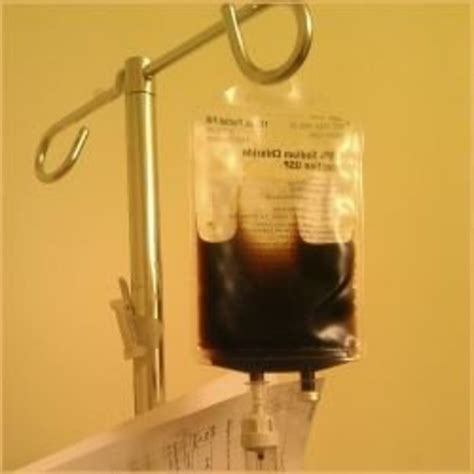 What It's Like to Have Anemia and Get an Intravenous Iron Infusion - Patient's Lounge