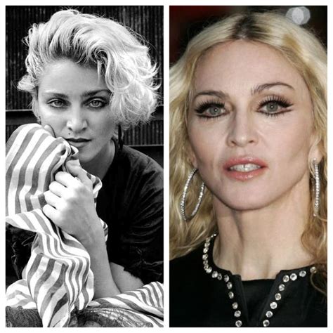 Madonna | Plastic surgery gone wrong, Plastic surgery, Madonna