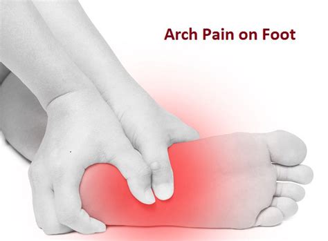 How to Prevent and Treat Foot Arch Pain – APTOCO.COM