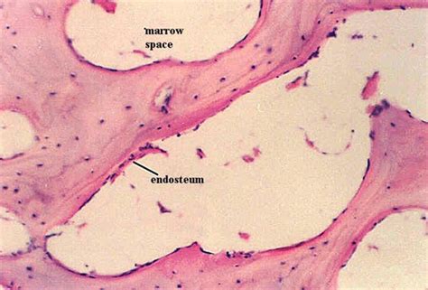 SPONGY BONE HISTOLOGY | Microanatomy Web Atlas | Gwen V. Childs, Ph.D.