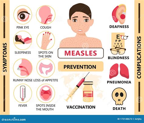 Measles Infographic Concept Vector. Infected Human with Papules on the Skin Stock Illustration ...