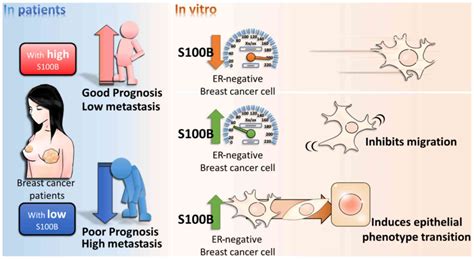 S100B expression in breast cancer as a predictive marker for cancer metastasis