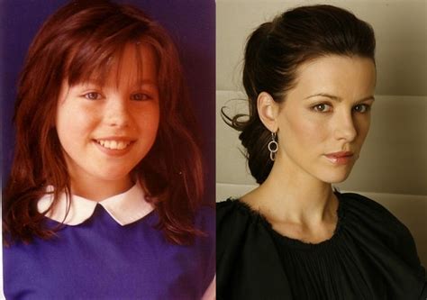 Kate Beckinsale Before and After Plastic Surgery: face, nose, breast