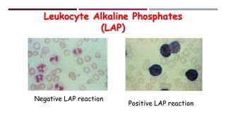 Leukocyte Alkaline Phosphatase Stain | PPT