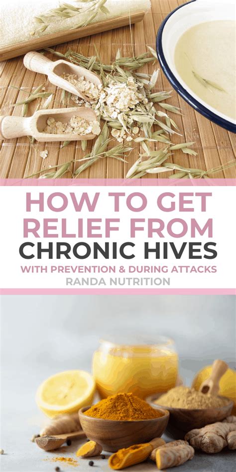 Turmeric Chicken Stir Fry and 5 Foods to Eat to Ease Chronic Hives | Randa Nutrition