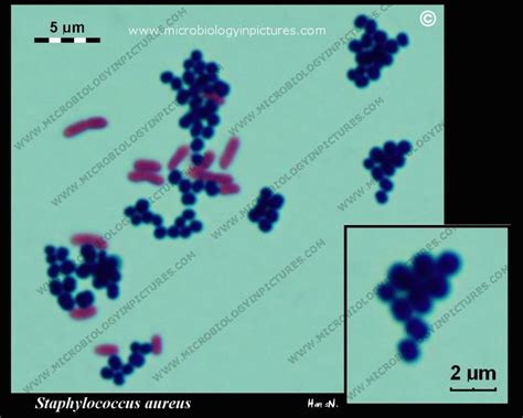 Gram-stain, Staphylococcus aureus and Escherichia coli. Gram staining ...