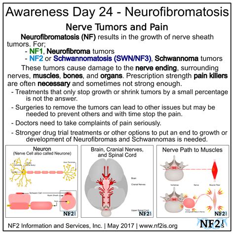 Neurofibromatosis Type 1 Causes Symptoms Treatment