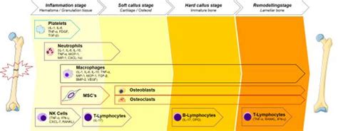 Bone Healing - Physiopedia