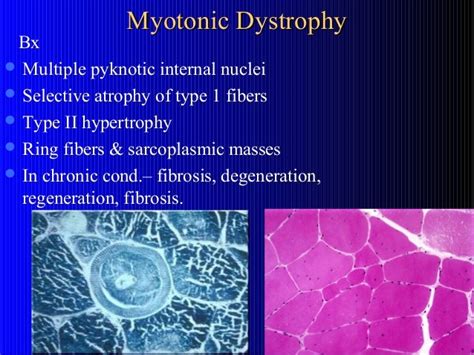 Muscle biopsy