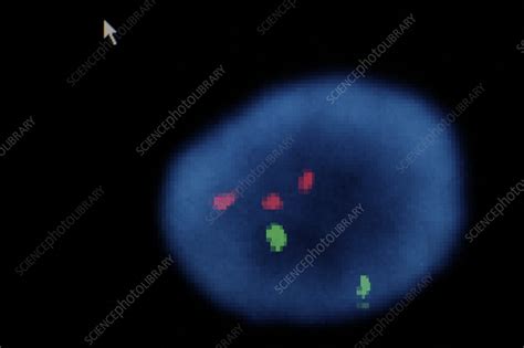 Karyotype analysis - Stock Image - C058/6161 - Science Photo Library