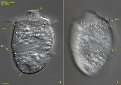 Didinium nasutum – Real Micro Life