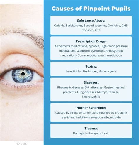 Why Do I Have Pinpoint Pupils? 6 Causes – NVISION