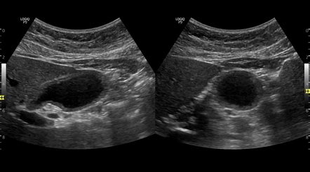 Viewing playlist: Abdomen | Radiopaedia.org