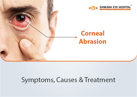 Corneal Abrasion: Symptoms, Causes & Treatment | Sankara