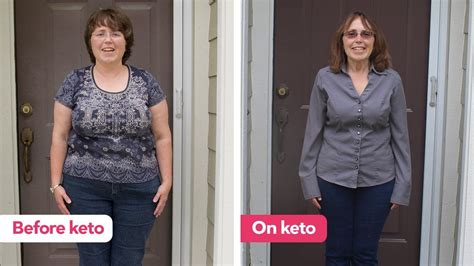 How Karen put both binge-eating and obesity into remission and shed ...