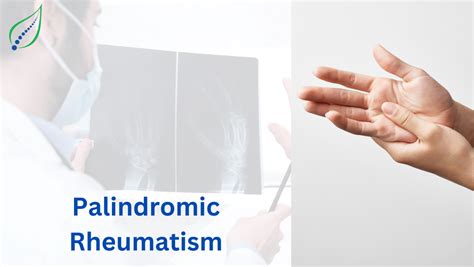 Palindromic Rheumatism: Symptoms, Causes & Management | Best Back Pain, Slip Disc, Knee ...