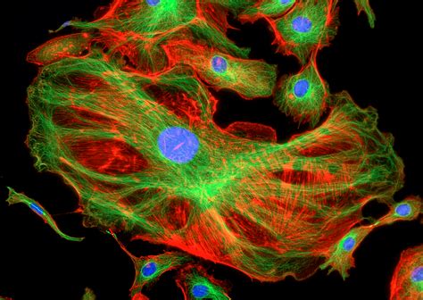 Picture Perfect: Capturing a High-Quality Fluorescent Microscopy Image ...