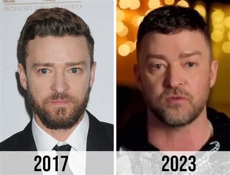 Fans Think Justin Timberlake Had 'Bad Plastic Surgery' After His Latest Public Appearance