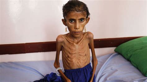 Five Years On, Saudi Attacks on Yemen's Farmers Are Pushing the Whole Country into Famine