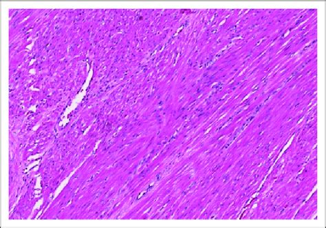 Myometrium