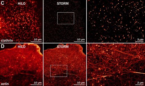 Article out: tips and tricks for Single Molecule Localization Microscopy – NeuroCyto Lab