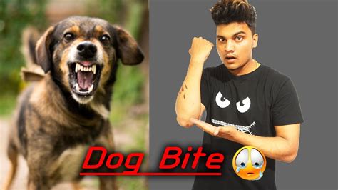 DOG BITE | Dog Bite Treatment Injections In 5 Rs Only :) | #Government ...