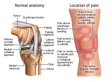 Difference Between Bursitis and Arthritis / RangerScott On Fuseink ...