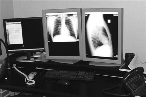 PACS Fundamentals | Radiology Key