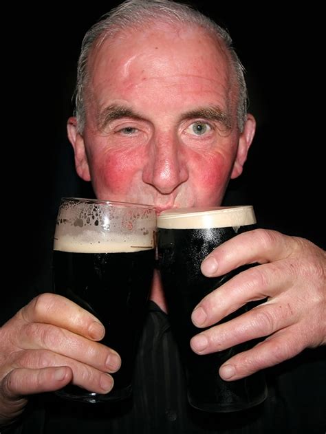 Red cheeks called ‘Alcohol flush’ may indicate deadly disease – New ...