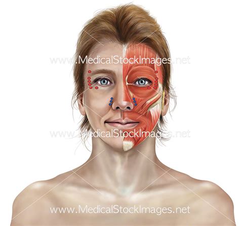 Botox Injection Points of Facial Muscle Anatomy and Skin – Medical Stock Images Company