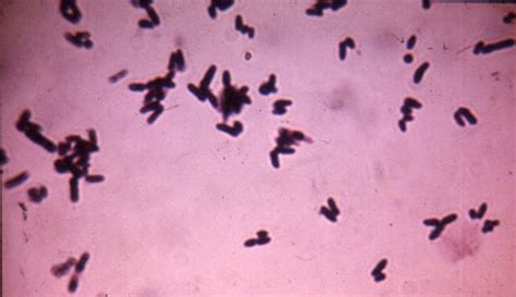 Environmental Reporter - Fungal Taxonomy; Microorganism: Corynebacterium