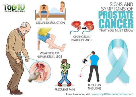 Signs and Symptoms of Prostate Cancer that You Must Know | Top 10 Home Remedies