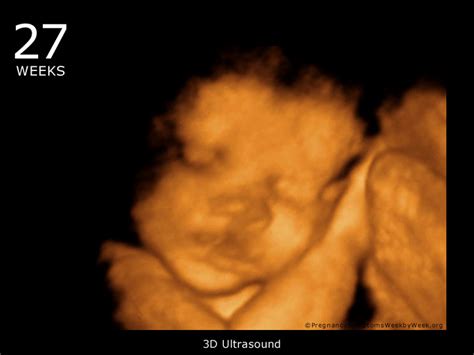 27 Week 3D Ultrasound Baby Picture | Pregnancy Symptoms Week by Week