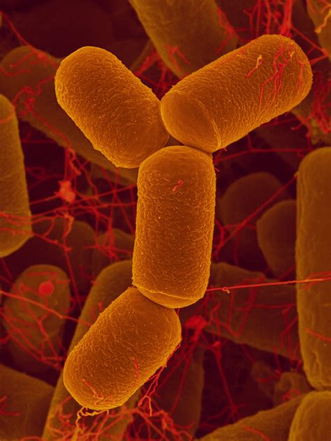 Gut Microbiome Archaea May Influence Childhood Asthma Risk - Pulmonology Advisor