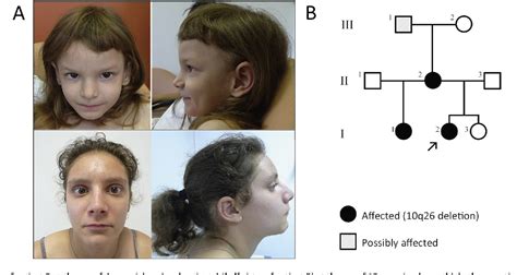 Table 1 from Distal 10q monosomy: new evidence for a neurobehavioral condition? | Semantic Scholar