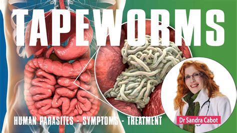 Video Human Parasites Get Rid Of Tapeworm, Roundworm, 53% OFF