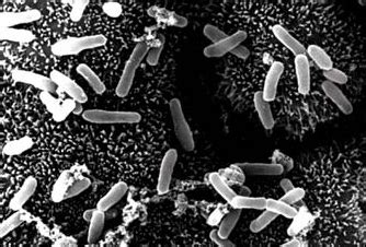 Clostridium - microbewiki