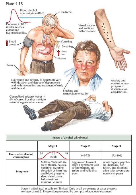 Alcohol Withdrawal - pediagenosis