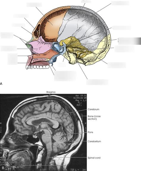 lateral aspect of interior of cranium Diagram | Quizlet