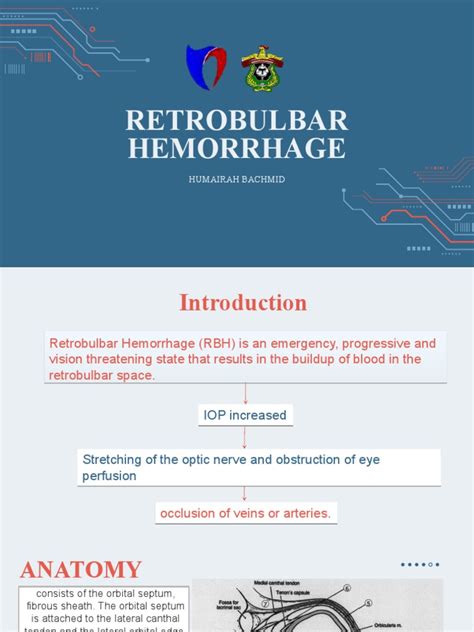 Retrobulbar Hemorrhage - HMR | PDF | Bleeding | Surgery