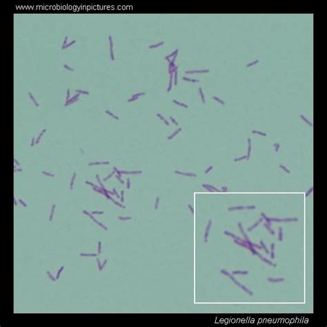 Legionella. Gram stain and cell morphology.Legionella micrograph, appearance under microscope ...