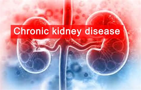 CKD patients who forego dialysis may have long survival with sustained ...