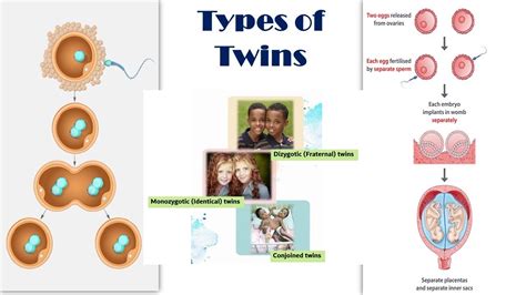 Types of Twins | Dizygotic (Fraternal) vs Monozygotic (Identical) Twins | Conjoined twins - YouTube