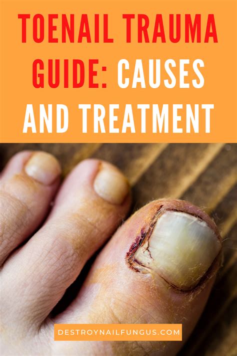 How To Fix A Dead Toenail: A 4-Step Ultimate Guide