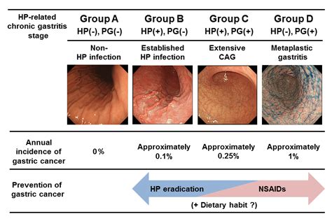 Gastric Cancer Risk Diagnosis and Prevention in Subjects with Helicobacter pylori-related ...