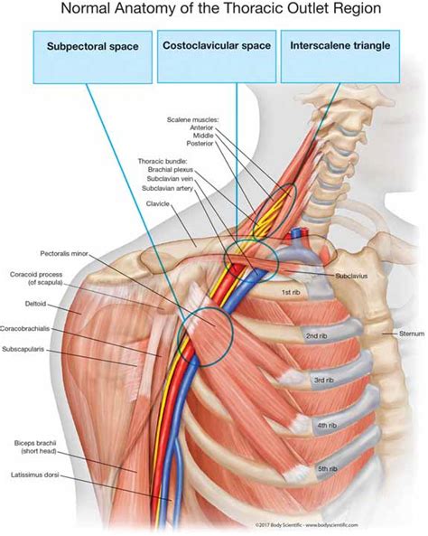 CHAPTER 1 - Thoracic Outlet Syndrome