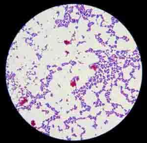 Acid Fast Stain Free Microbiology Images from Science Prof Online